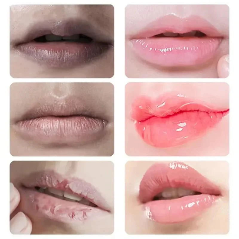 Lip Balm For Remove Dark Lip Melanin Dead Skin Removal Lighten Lip Lines Exfoliate Whitening Moisturizing Nourishing Serum 8.5g